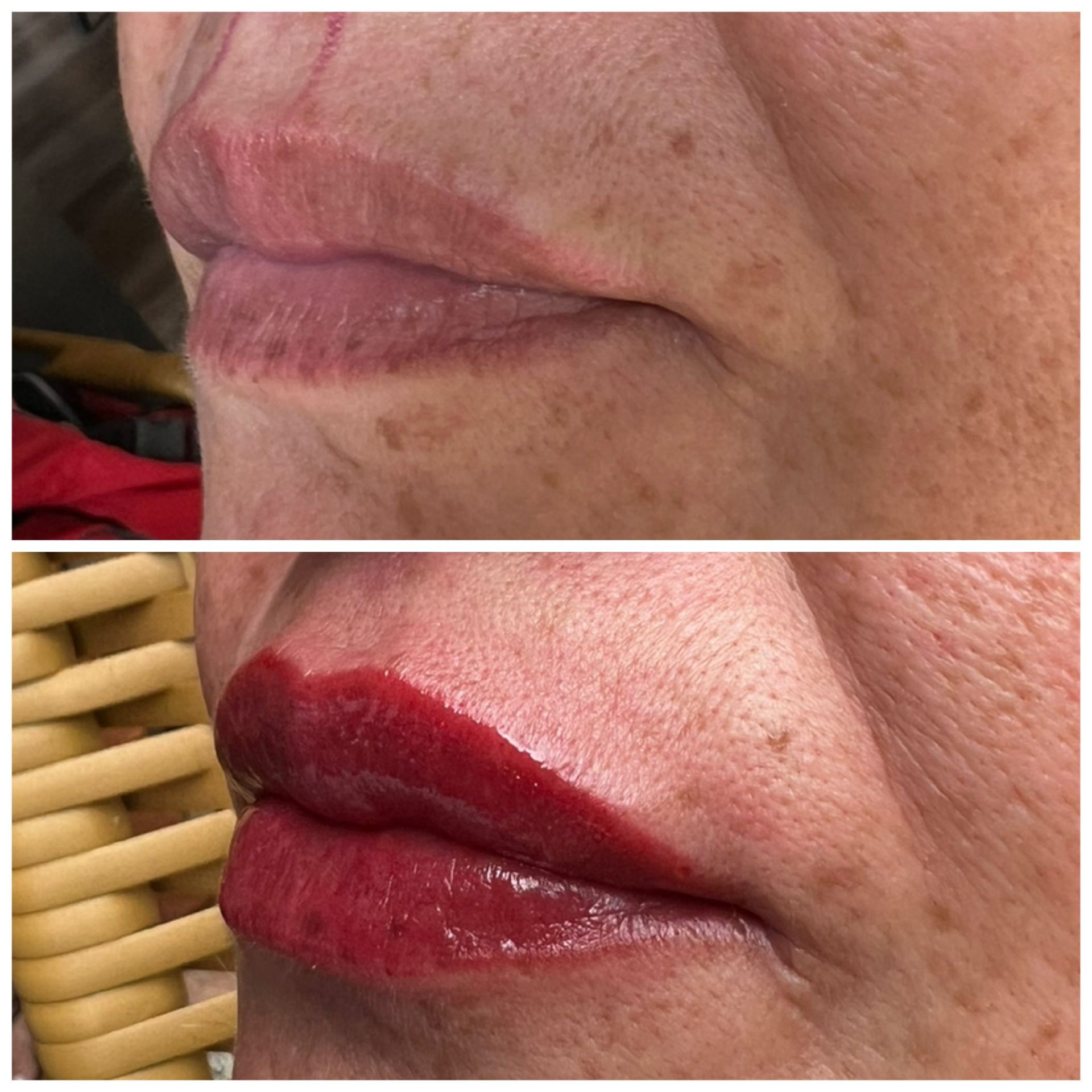 Lip micropigmentation — before & after