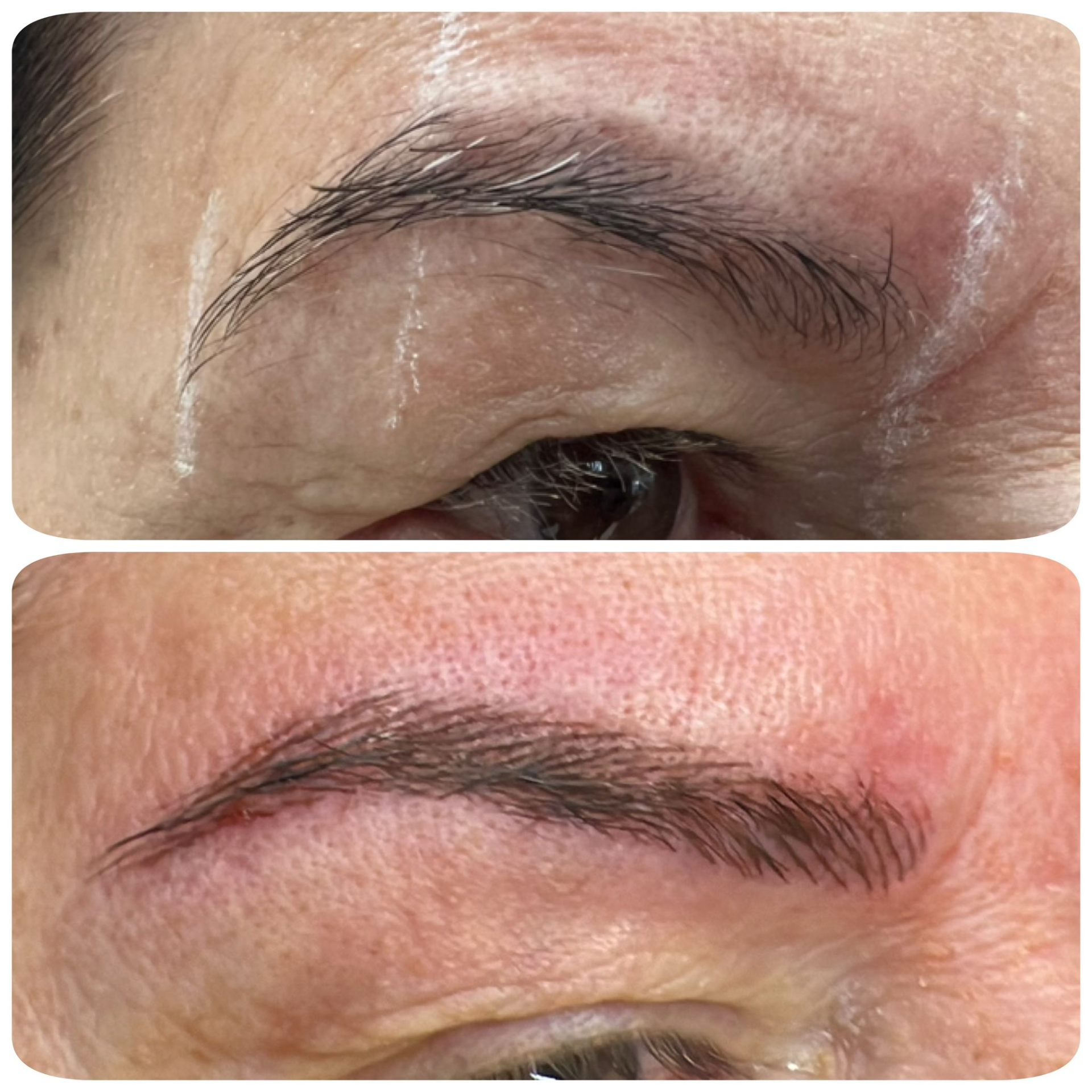 Brow design — before & after
